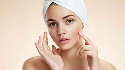 How to Choose the Right Acne Products for Your Skin Type